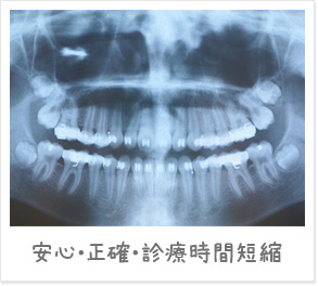 デジタルレントゲン